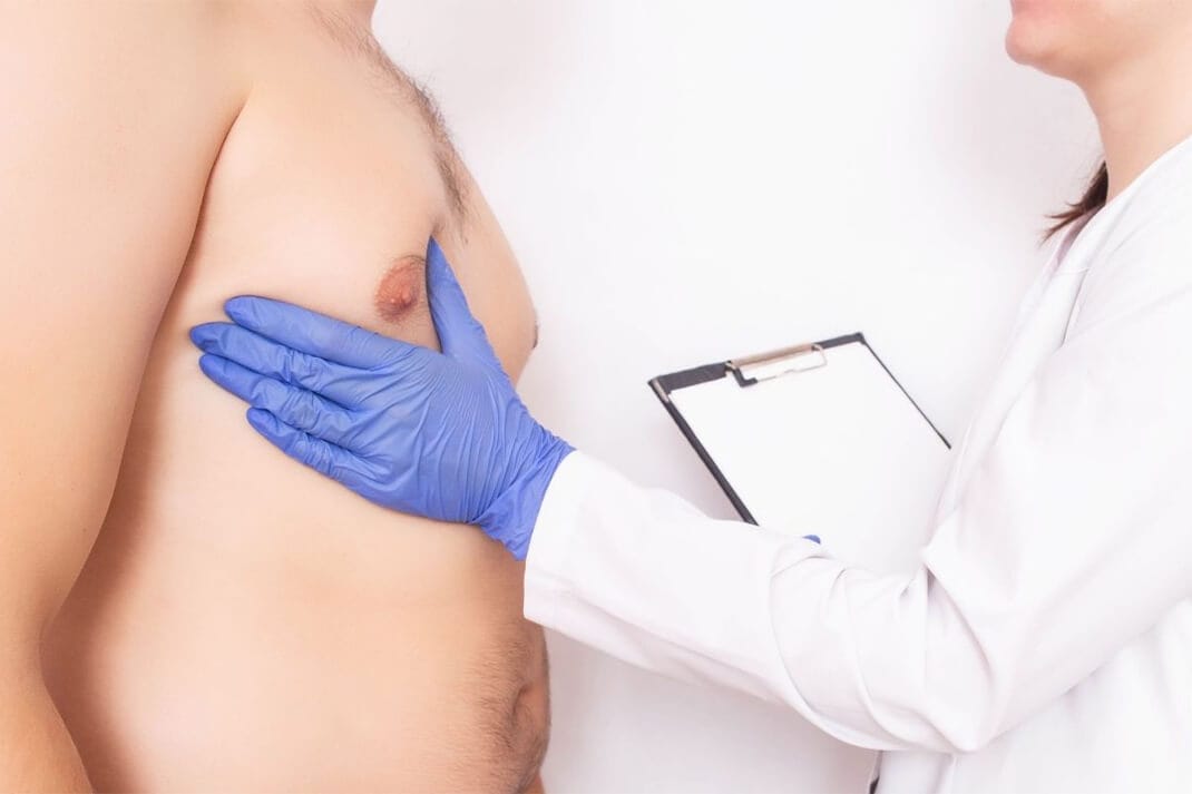 Gynecomastia in Turkey