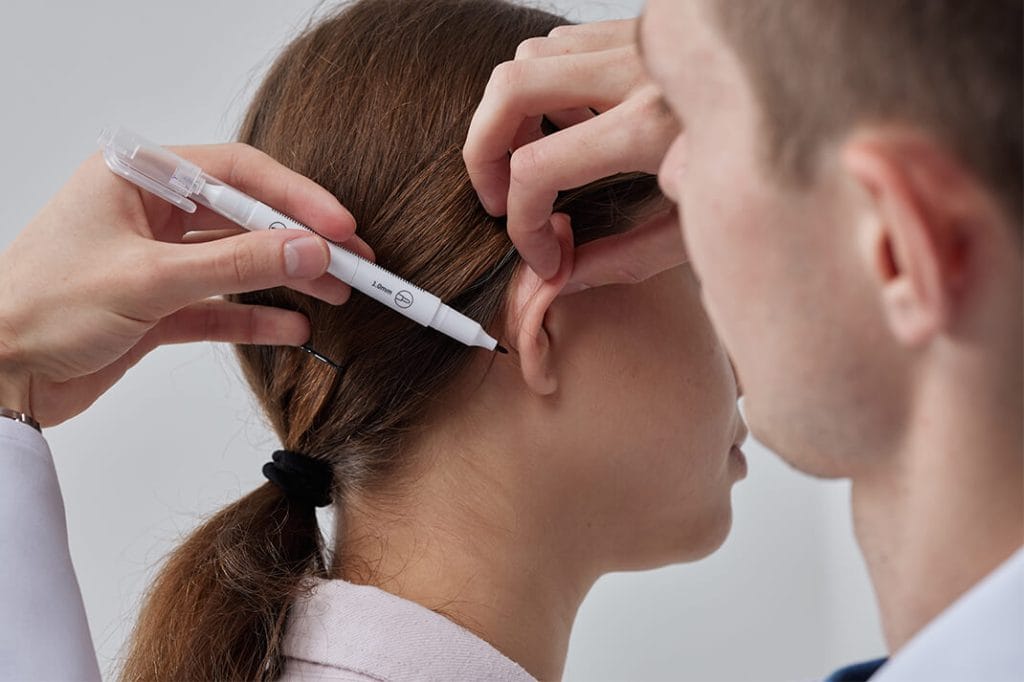 Otoplasty (Pominent Ear) in Turkey