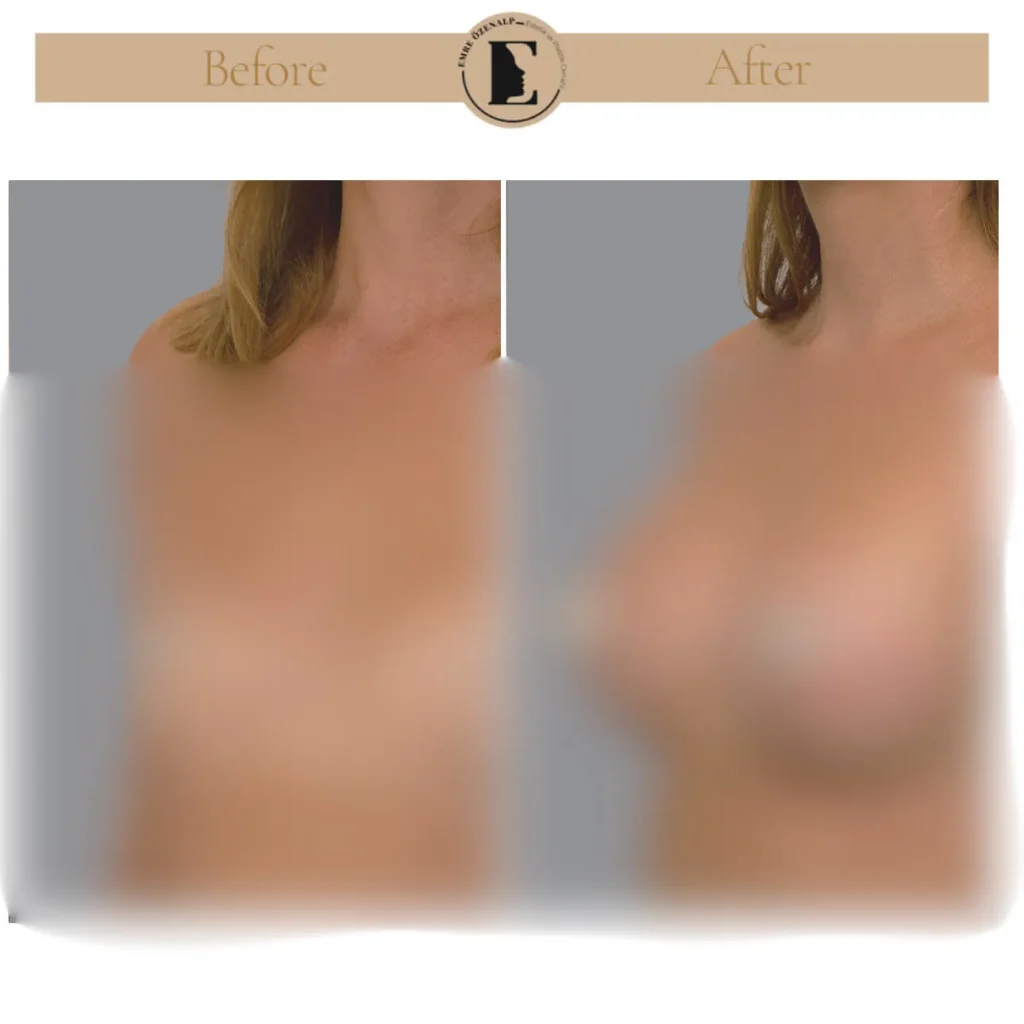 Motiva Preserve meme büyütme öncesi ve sonrası sonuçları